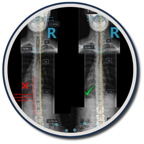 Gonstead X-rays in Rancho Cucamonga